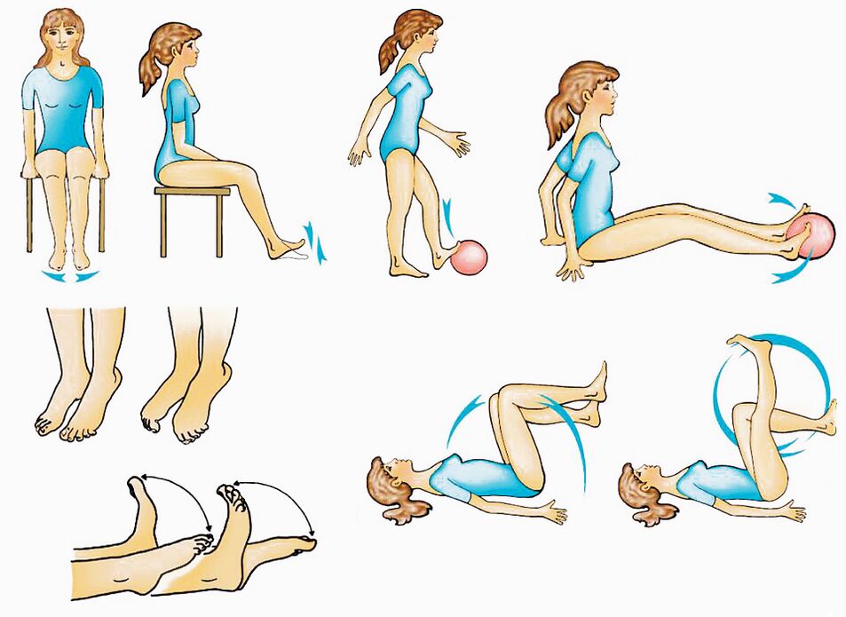 Exercicios físicos para varices